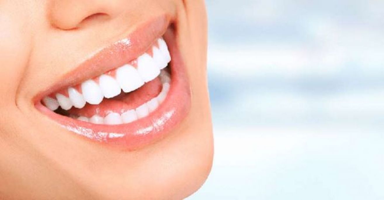 Blanchiment dentaire Professionnel à Caluire-et-Cuire (69) Par Sandy - Estheca