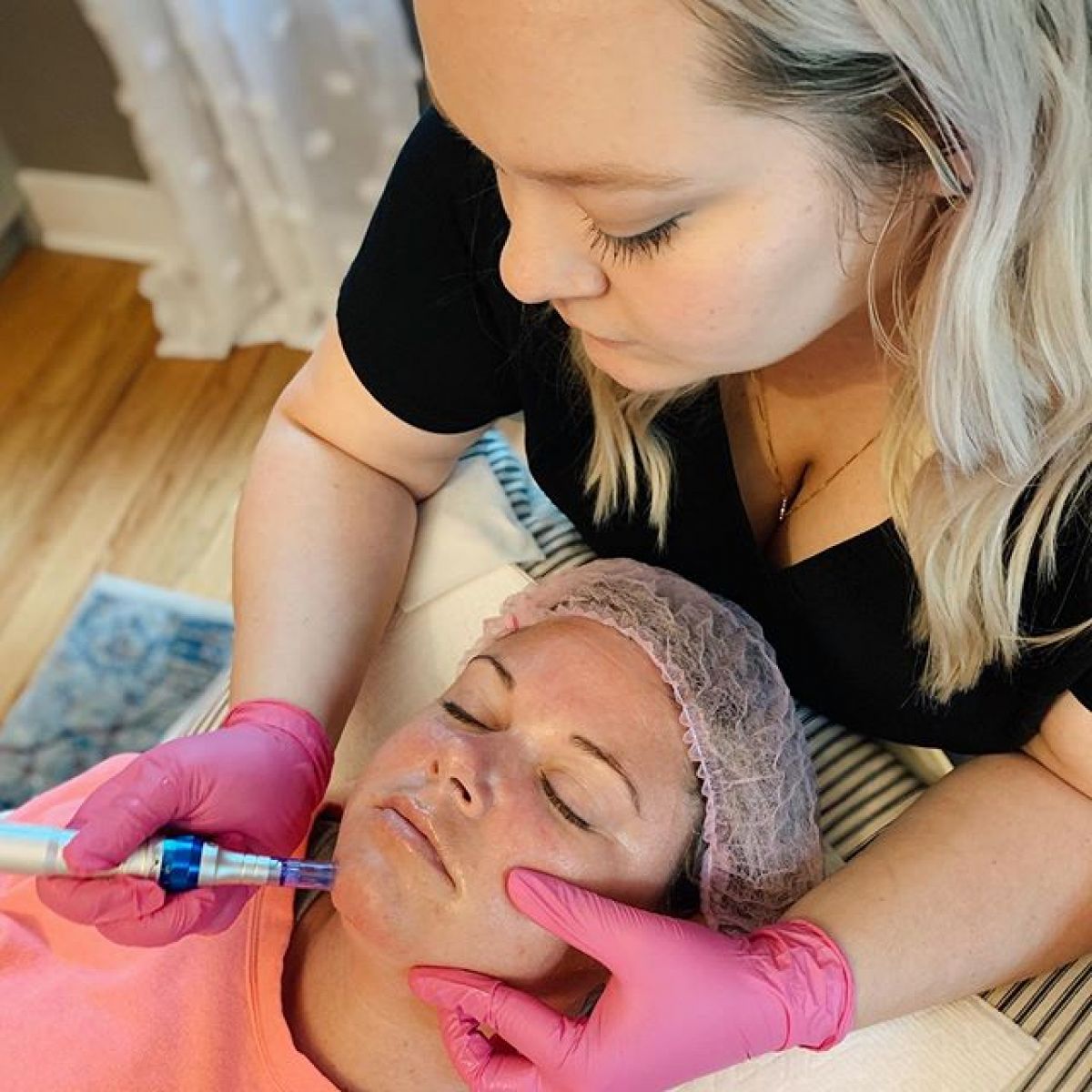 MicroNeedling BBGlow à Colombes (92) Par Charlotte - Estheca