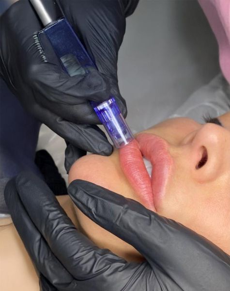 À Guénange | BB lips ( lèvres ) | Les meilleures esthéticiennes