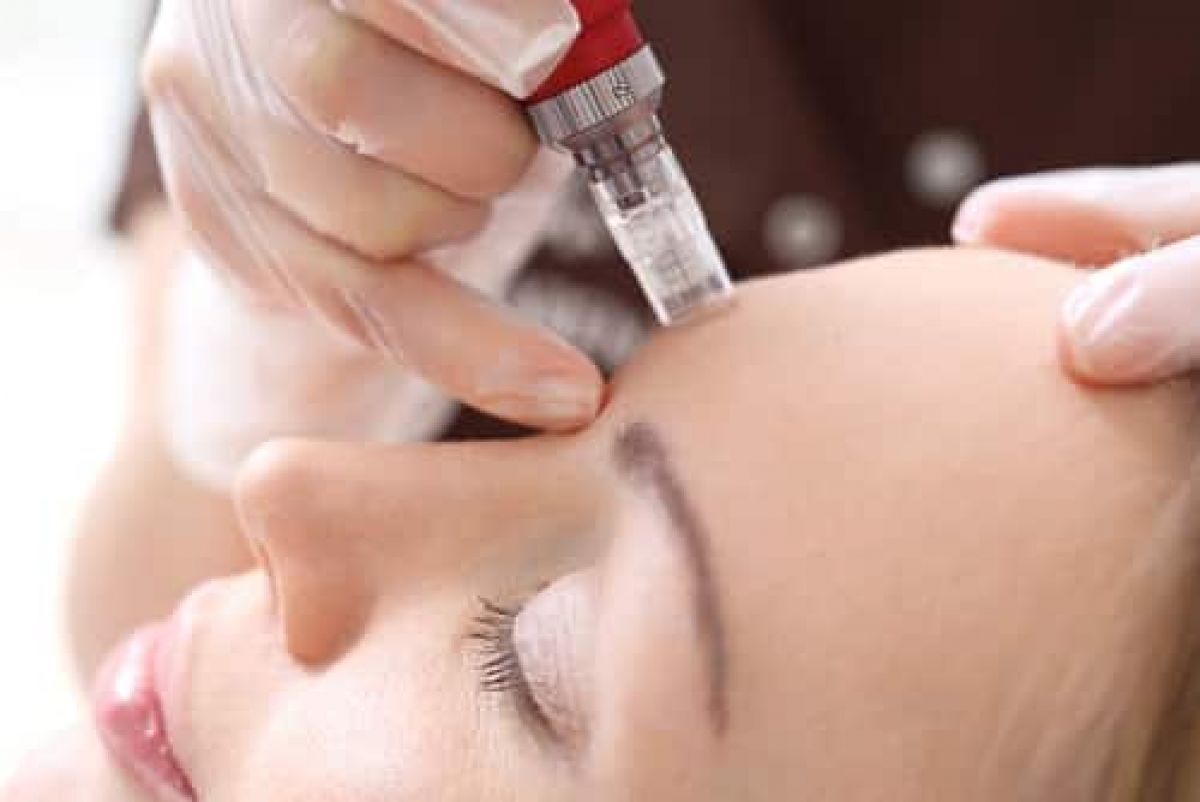 Microneedling / BB GLOW à Nice (06) Par Olivia - Estheca