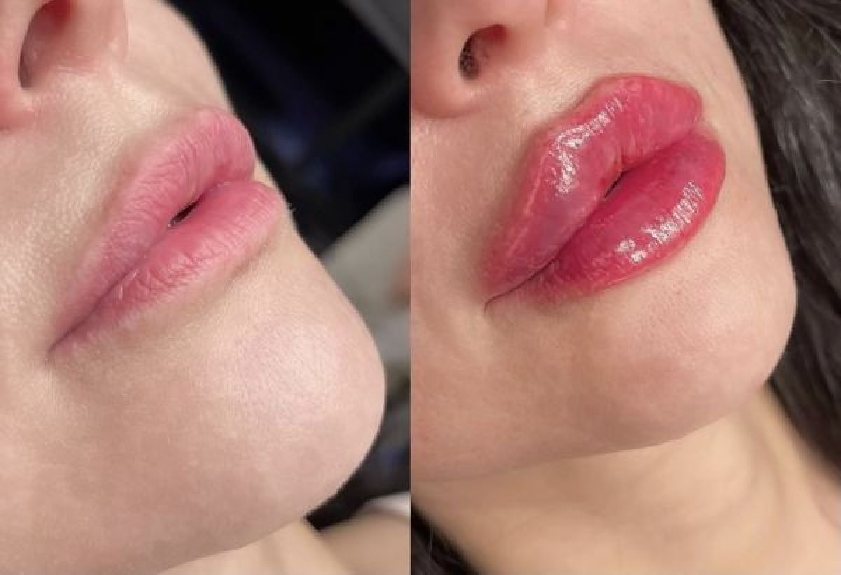 Russian lips à Toulon (83) Par Daria - Estheca