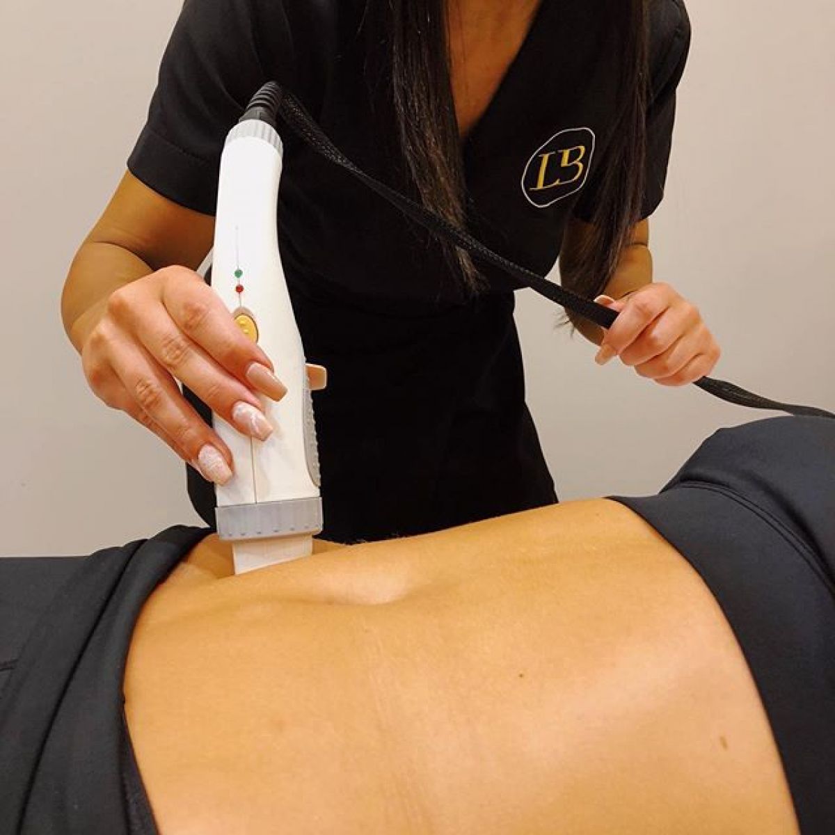 Radio fréquence et Lipocavitation à Saint-Herblain (44) Par Mélissa - Estheca