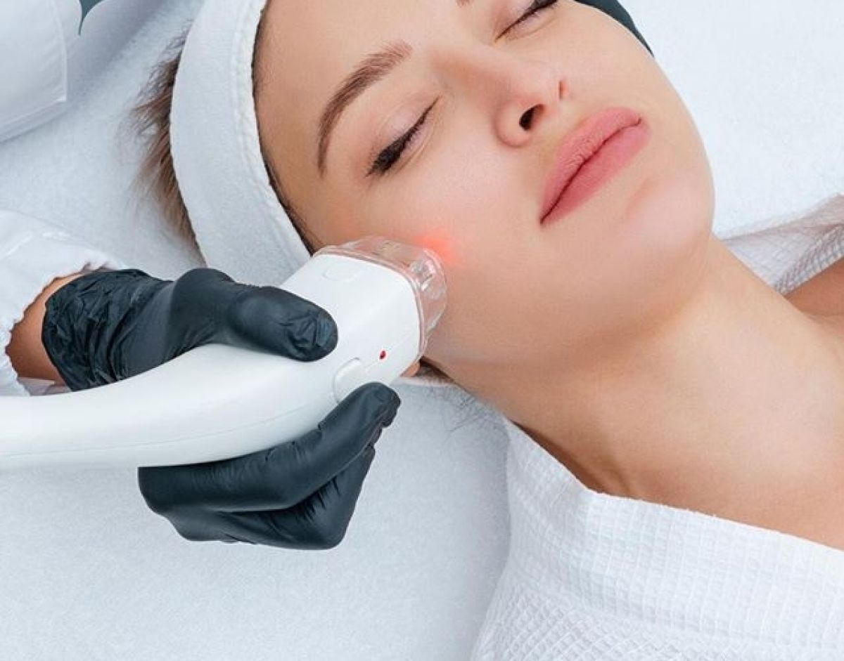 MicroNeedling BB Glow à Andrézieux-Bouthéon (42) Par Virginie - Estheca