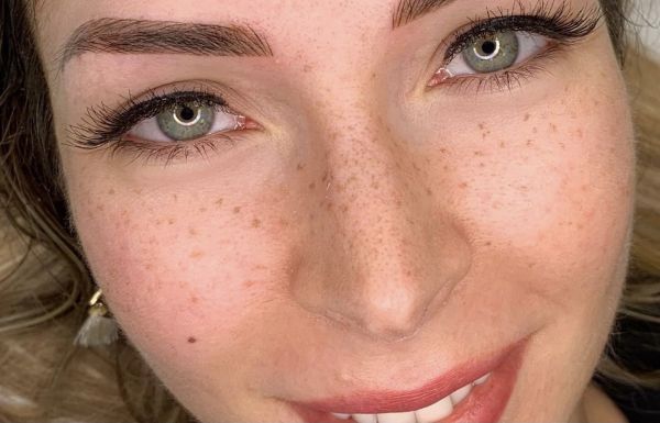 À Vaugneray | Tâches de rousseur/Grain de beauté | Les meilleures esthéticiennes