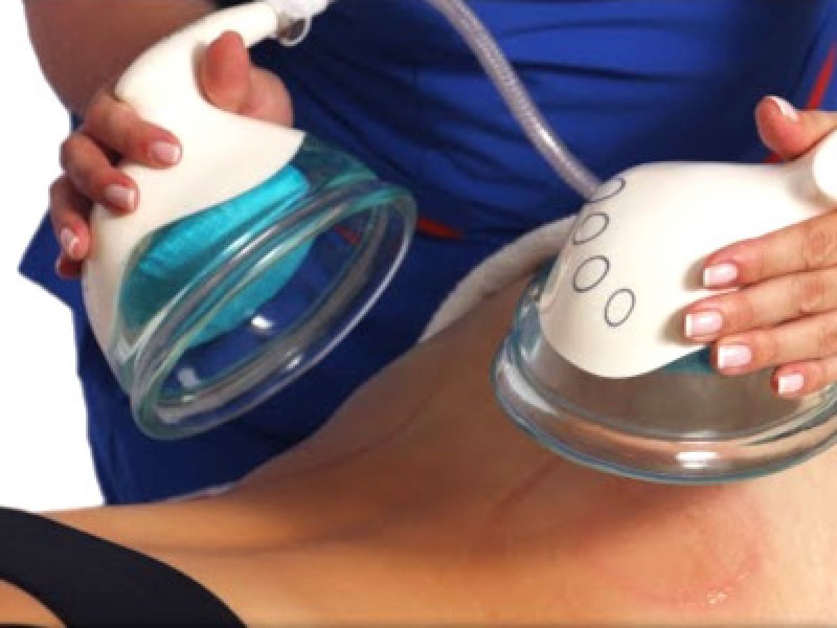 Lifting Colombien à Souffelweyersheim (67) Par Claire - Estheca