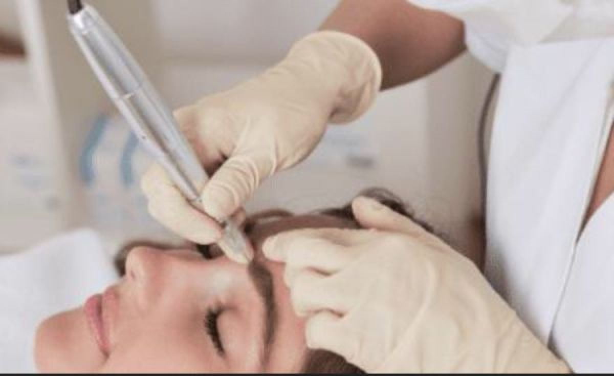 Détatouage sans laser à Le Pontet (84) Par Asmae - Estheca