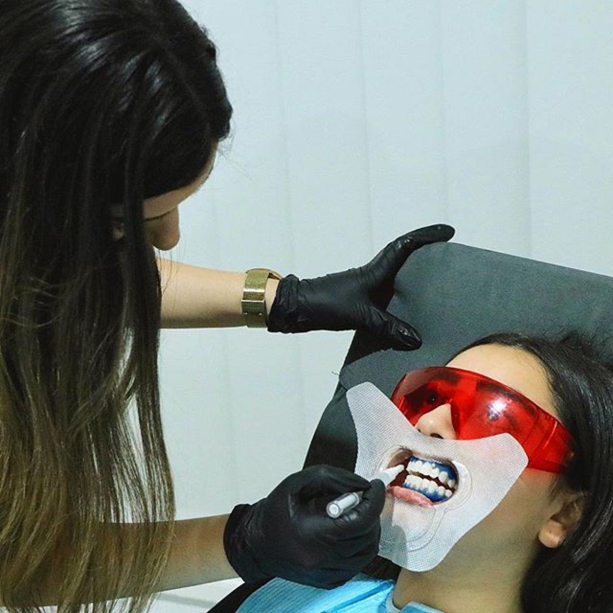 Blanchiment dentaire Pro à Muret (31) Par Mélanie - Estheca