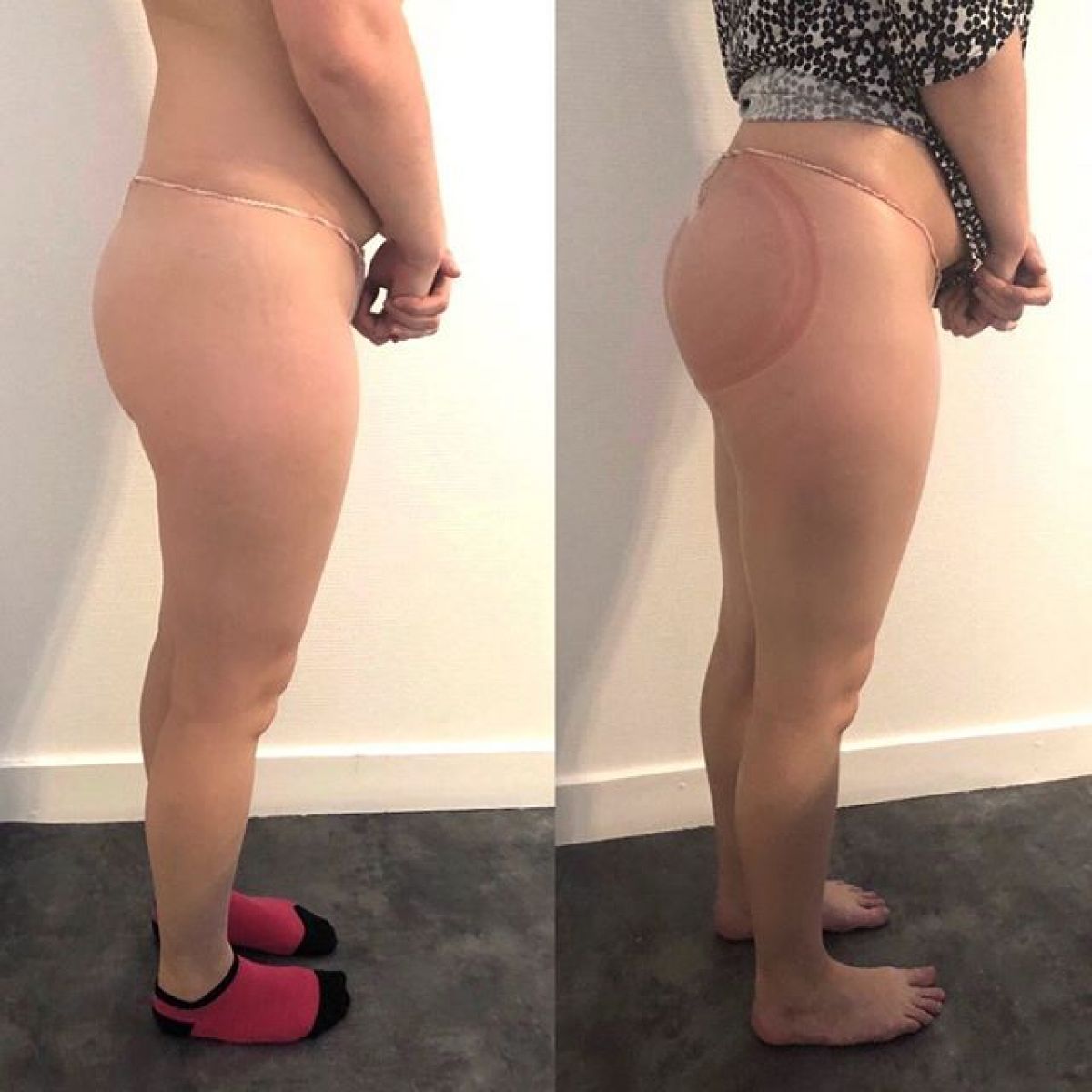 Lifting Colombien à Blagnac (31) Par Océane - Estheca