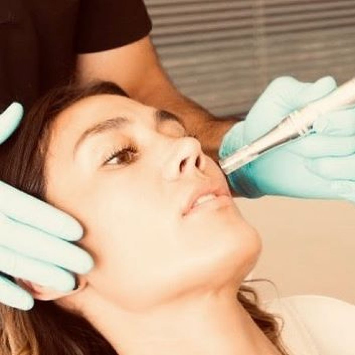 MicroNeedling BBGlow à Saint-Denis (93) Par Yasmine - Estheca
