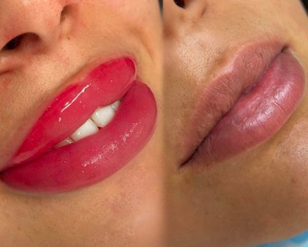 À Thionville | Maquillage permanent (Candy lips et Blusheffect) | Les meilleures esthéticiennes