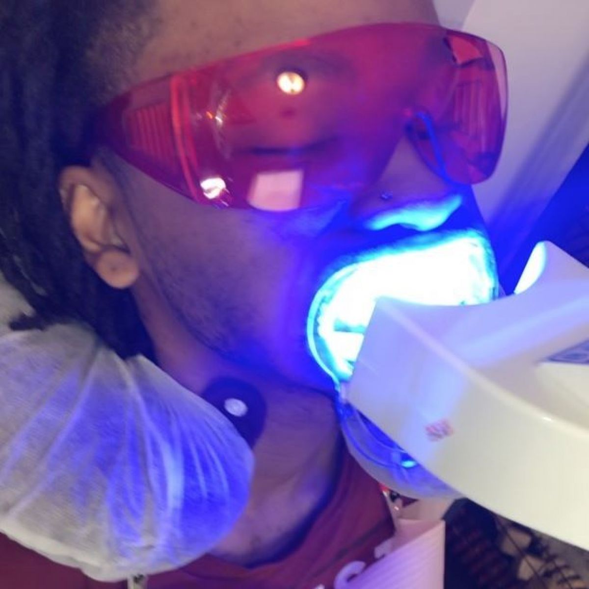 Blanchiment dentaire Professionnel à Hœnheim (67) Par Mylène - Estheca