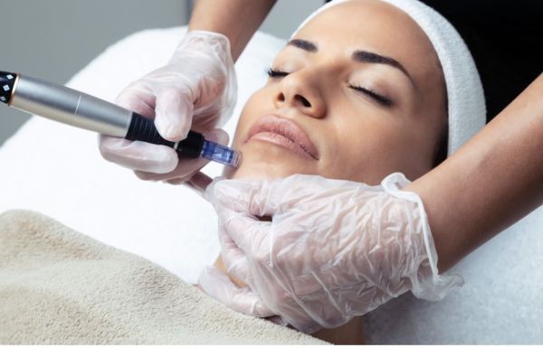À Villiers-le-Bel | Microneedling(traite les rides, les taches, les pores  ...) | Les meilleures esthéticiennes