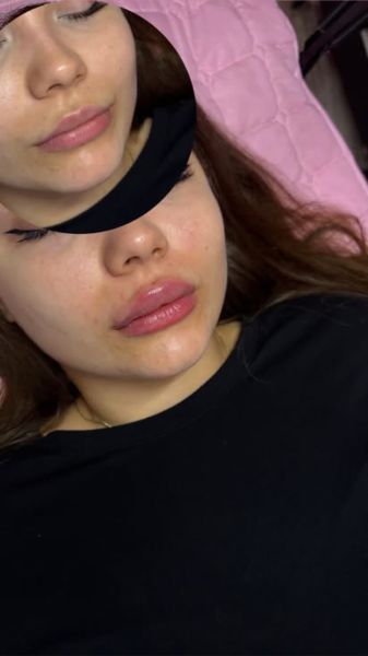 À Tours | Russian lips / Augmentation des lèvres (sans injections) | Les meilleures esthéticiennes