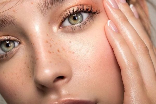 À Bruges | Tâches de rousseur / Grain de beauté | Les meilleures esthéticiennes