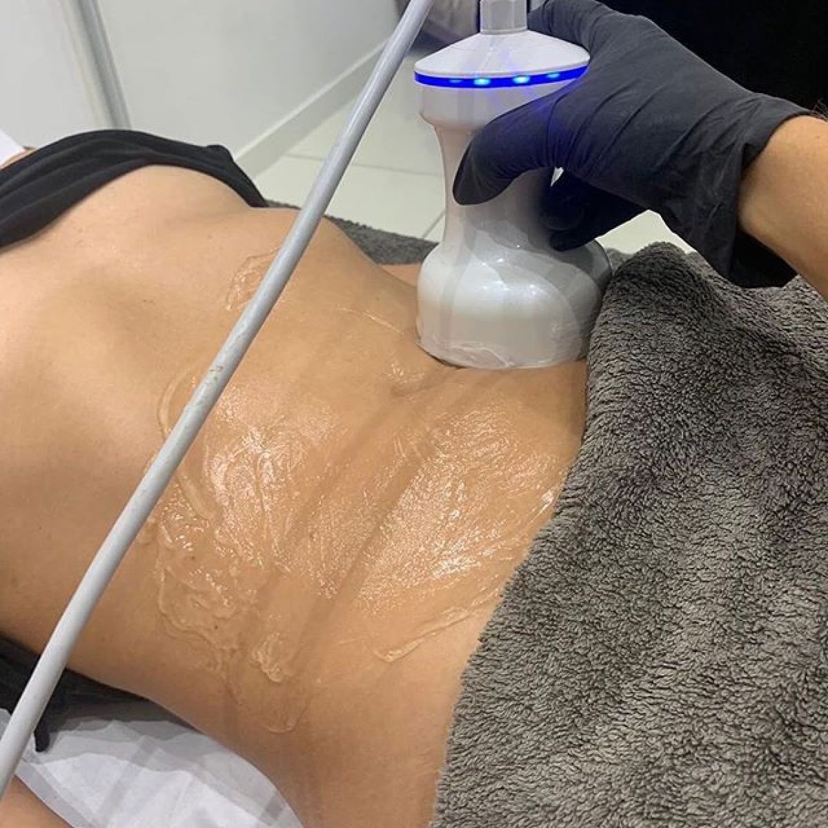Radio fréquence / Lipocavitation à Rosny-sous-Bois (93) Par Céline - Estheca