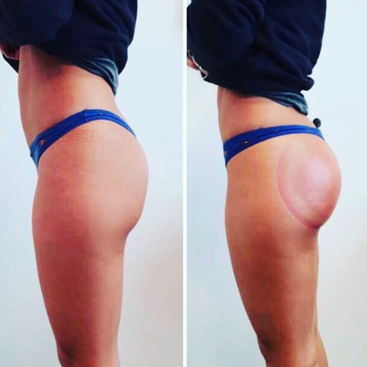 Lifting Colombien à Marcq-en-Baroeul (59) Par Inès - Estheca