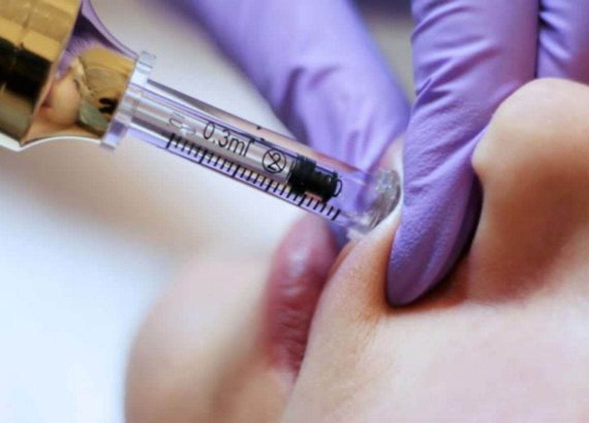 Hyaluronpen à Marseille (13) Par Sarah - Estheca
