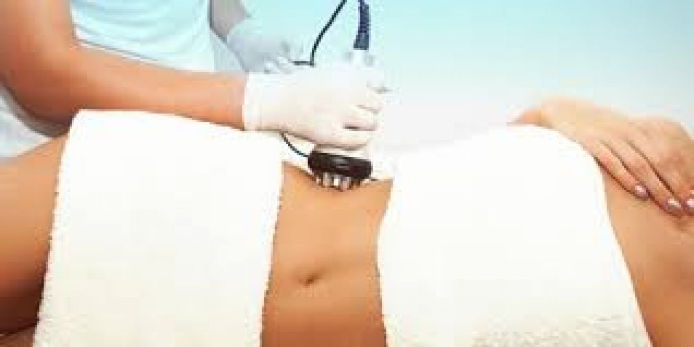 Radio fréquence - Lipocavitation à Noisy-le-Grand (93) Par Angélique - Estheca