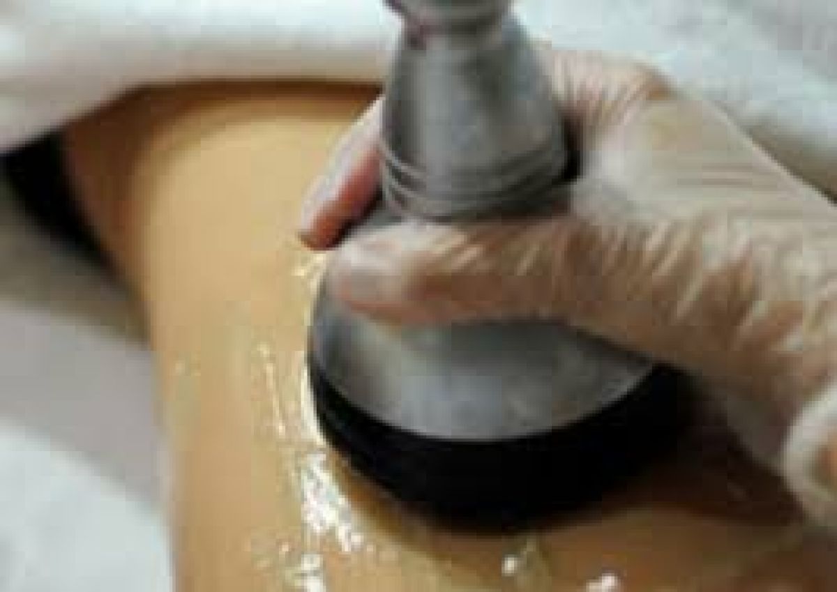 Radio fréquence - Lipocavitation à Villepinte (93) Par Nadège - Estheca