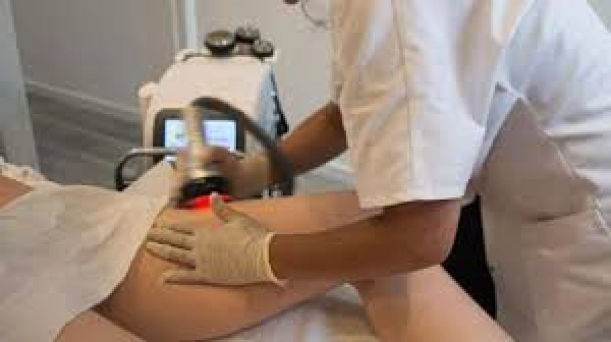 Radio fréquence / Lipocavitation à Bordeaux (33) Par Claire - Estheca