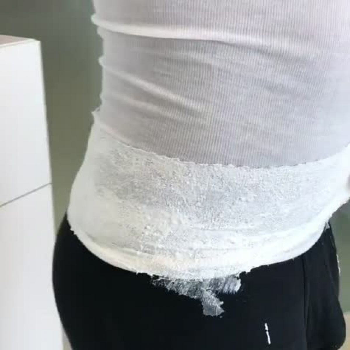 Maigrir Avec Un Plâtre à La Jambe Yesotherapie (plâtre thérapie) à Nantes (44) Par Myriam - Estheca