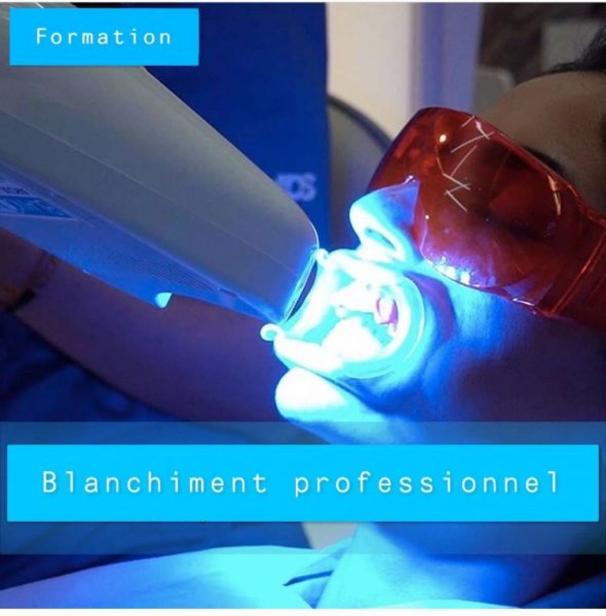 Formation blanchiment dentaire professionnel  à Marcq-en-Baroeul (59) Par Myriam - Estheca