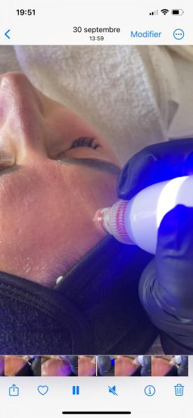 À Reims | Hydra facial | Les meilleures esthéticiennes