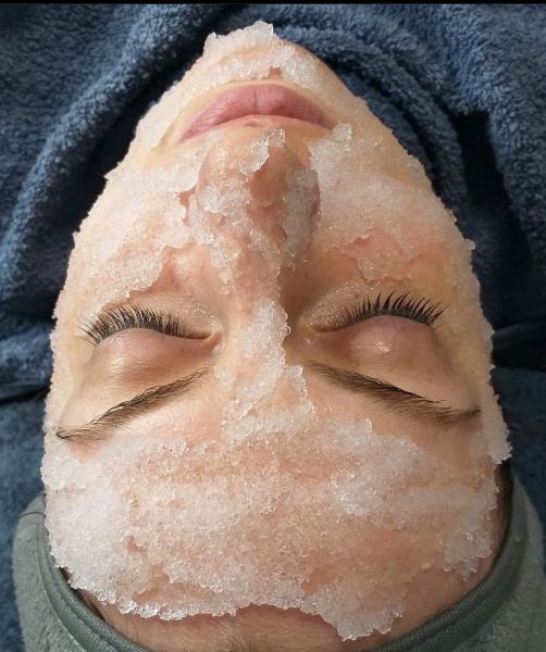 À Alès | Cryotherapie  | Les meilleures esthéticiennes