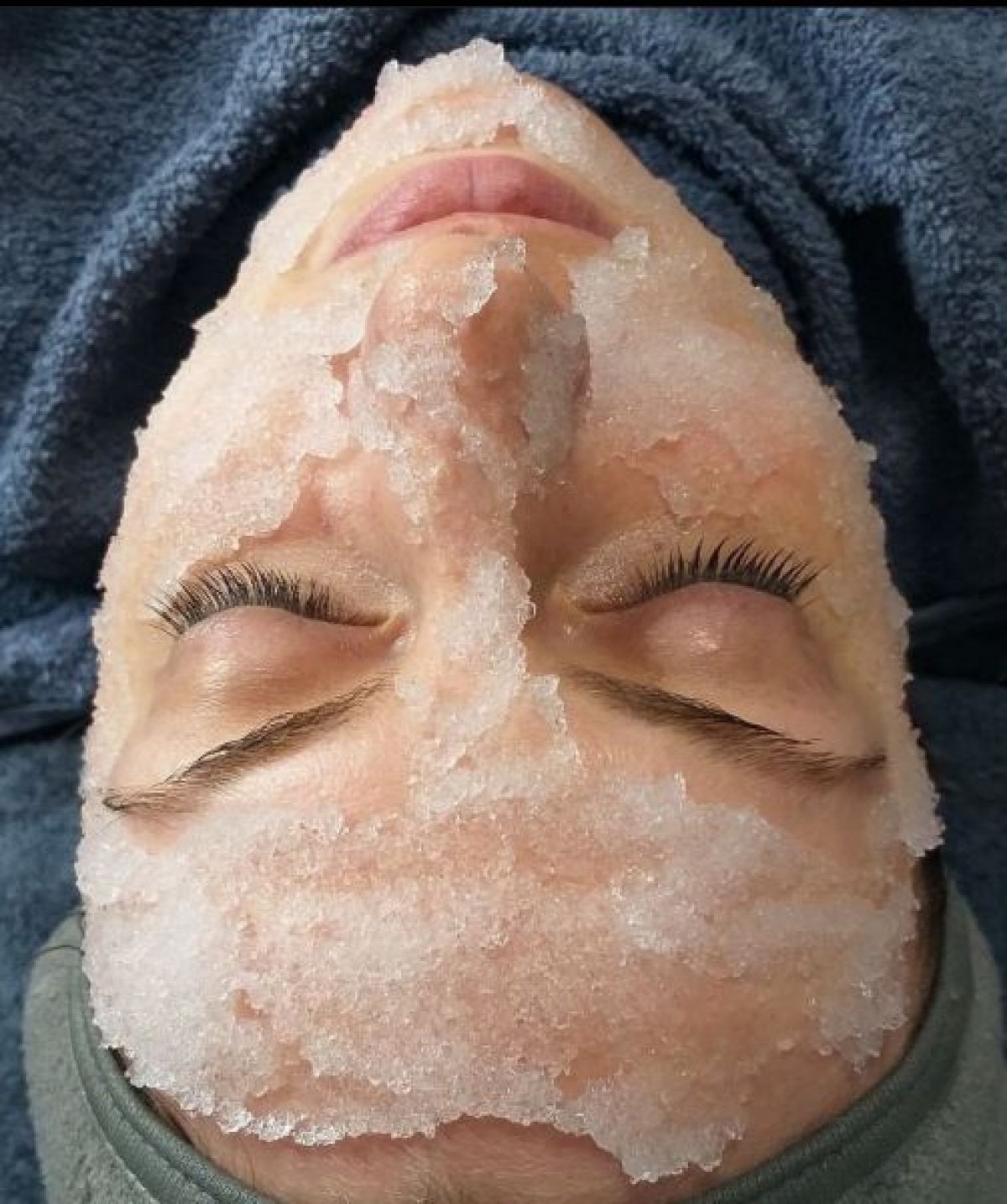 Soin Cryothérapie facial à Béthune (62) Par Marie - Estheca