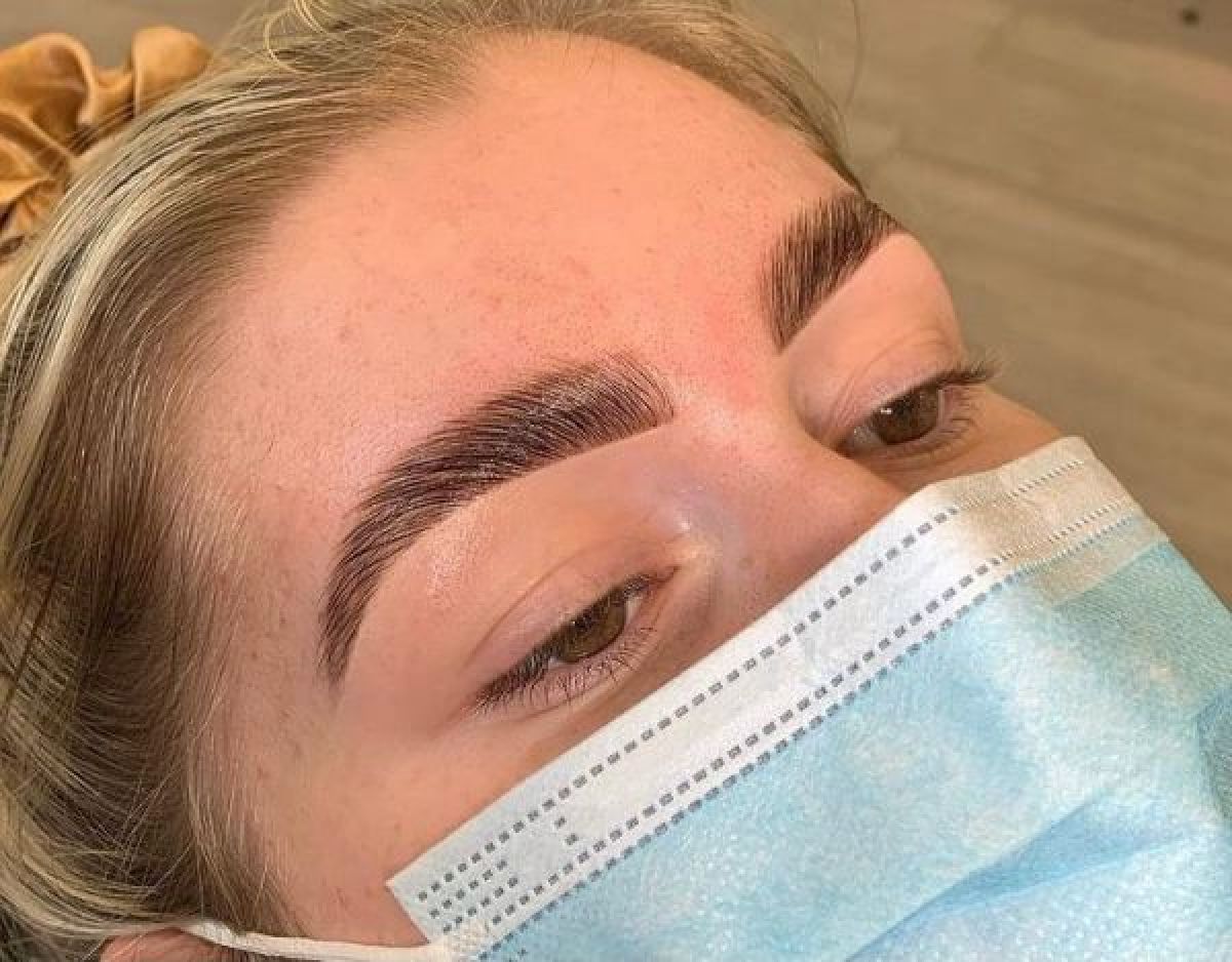 Brow lift (rehaussement de sourcils) à Antibes (06) Par Rachelle - Estheca