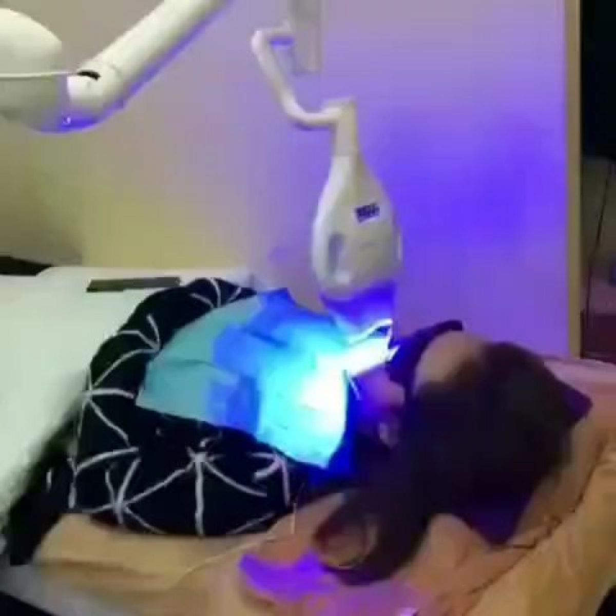 Blanchiment dentaire Professionnel à Lingolsheim (67) Par Camille - Estheca