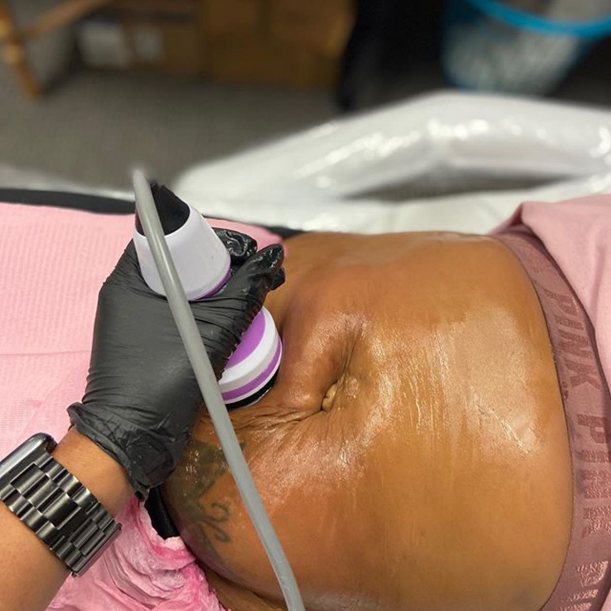 Radio fréquence et Lipocavitation à Bègles (33) Par Pauline - Estheca
