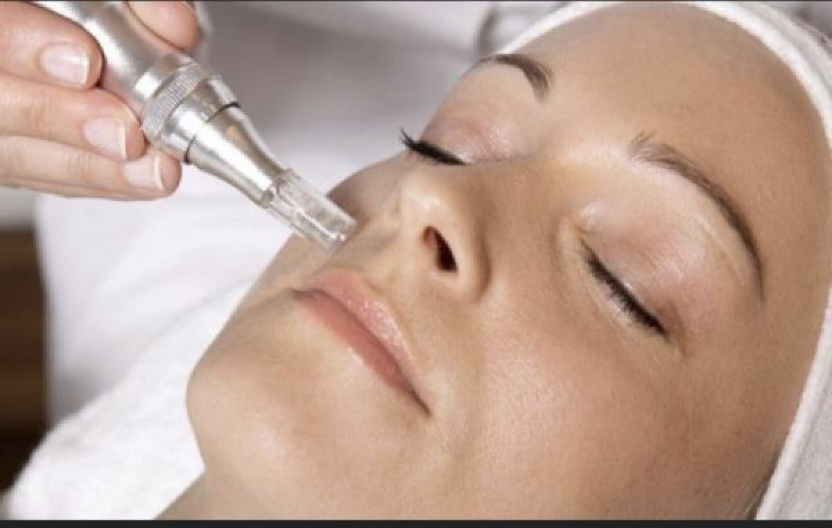 Microneedling BB GLOW à Lyon (69) Par Somia - Estheca