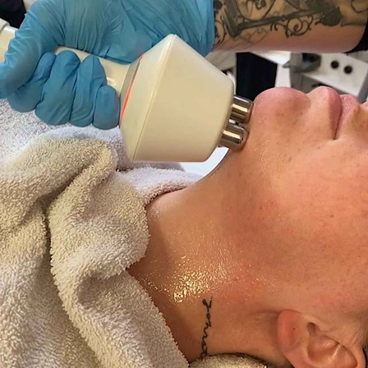 Radio fréquence et Lipocavitation à Corbeil-Essonnes (91) Par Manel - Estheca
