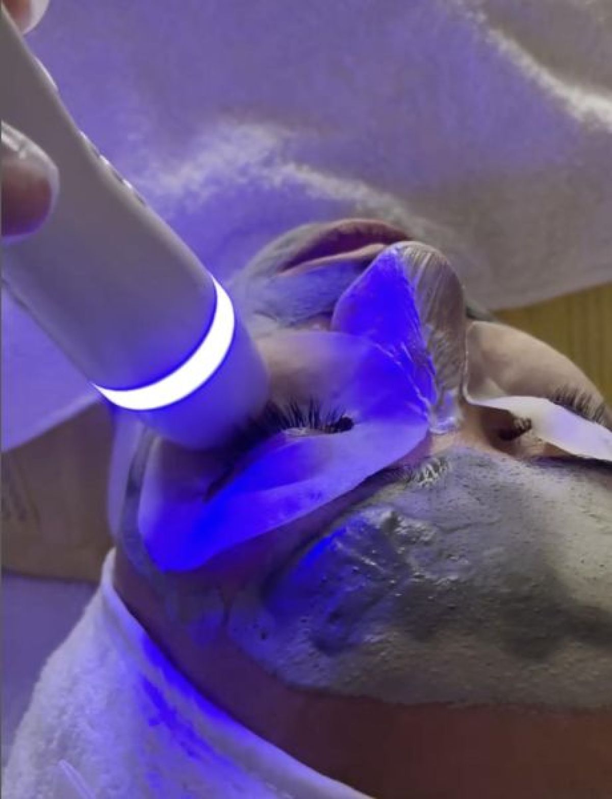 Neutralisation des cernes à Reims (51) Par Arpine - Estheca