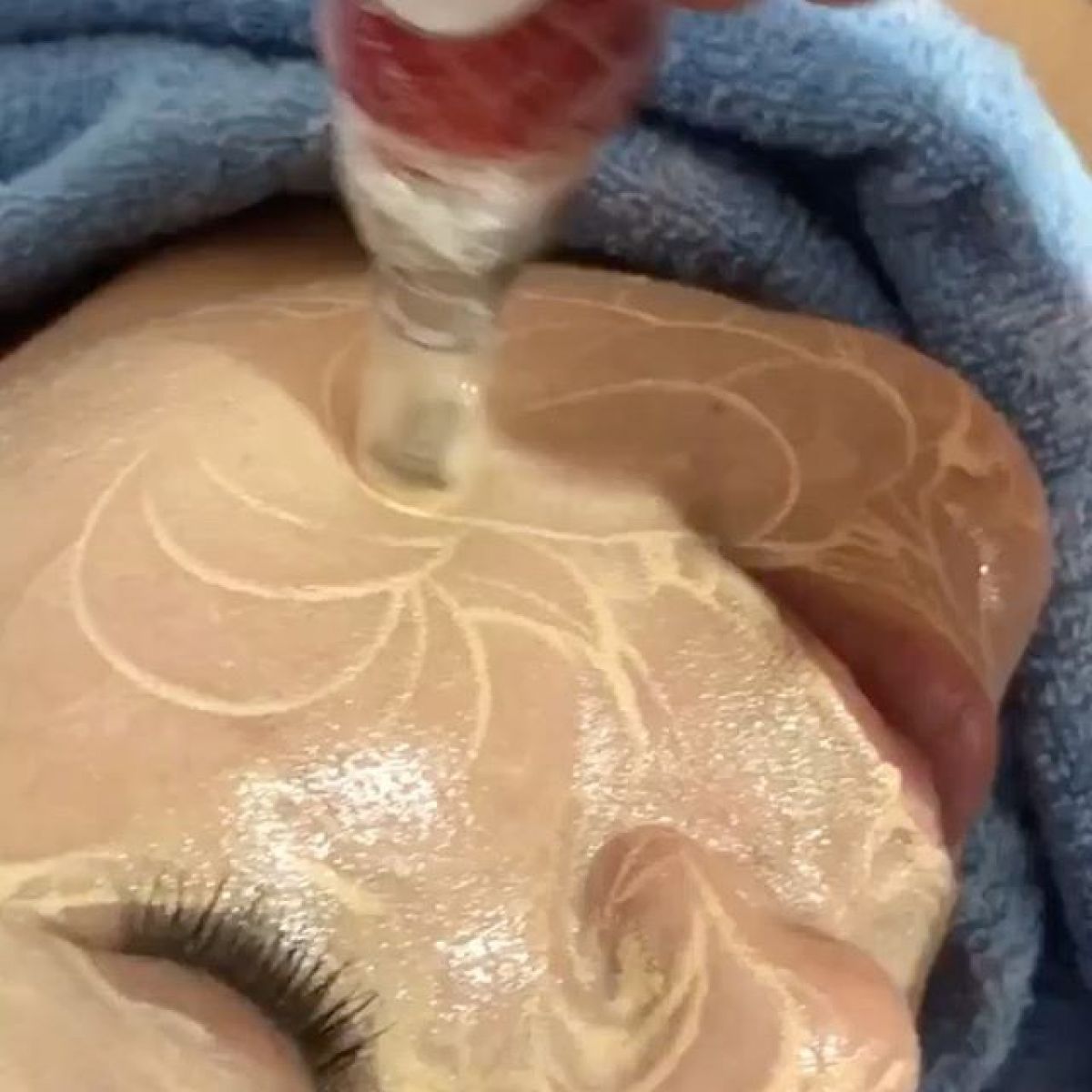 MicroNeedling BB Glow à Saint-Sébastien-sur-Loire (44) Par Marion - Estheca