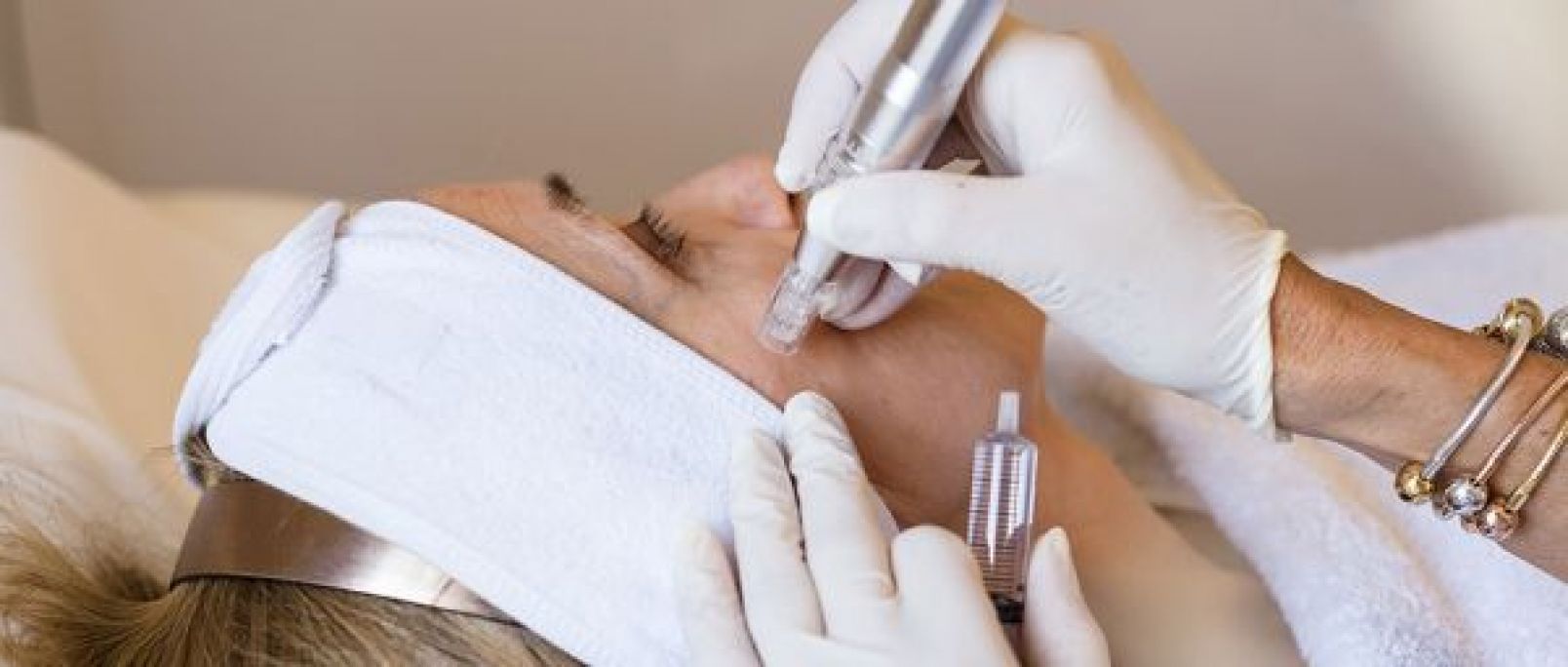 Mesolift réhydrater /mésothérapie anti-âge   à Tourcoing (59) Par Fatima - Estheca