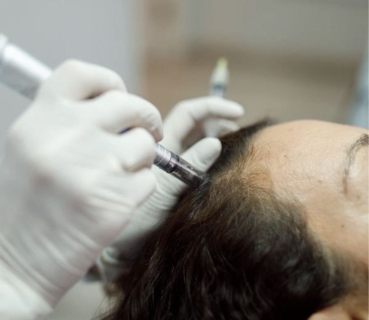 Hair Boost – Stop Chute & Repousse à Thionville (57) Par Kelly - Estheca