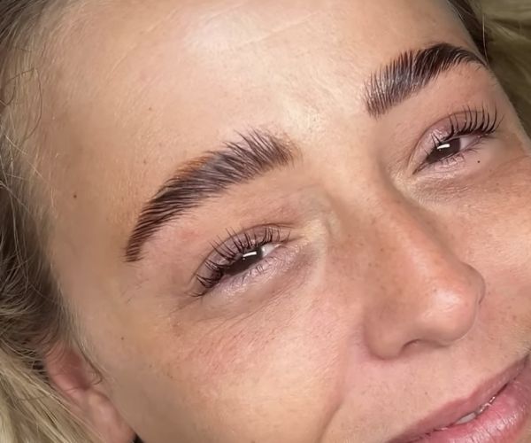 À Biarritz | Browlift (rehaussement de sourcils) | Les meilleures esthéticiennes