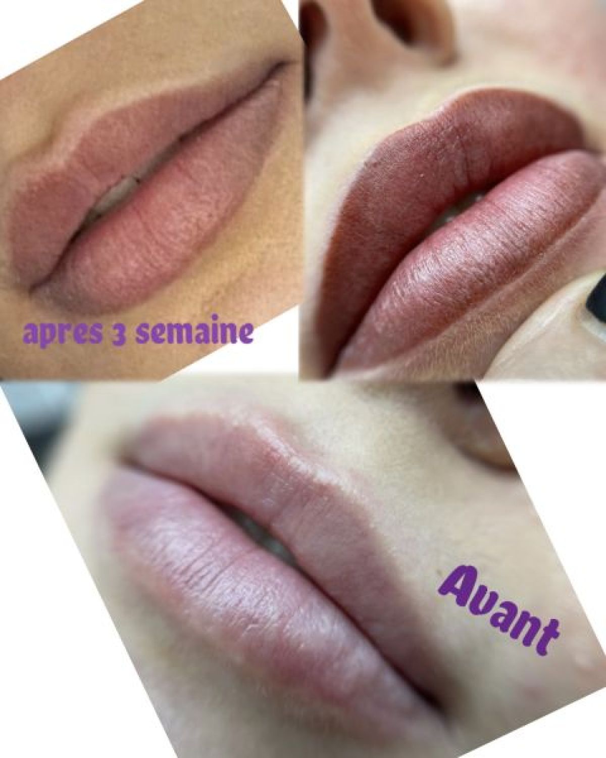 Maquillage permanent (contour lèvres)  à Creil (60) Par Alexandra - Estheca
