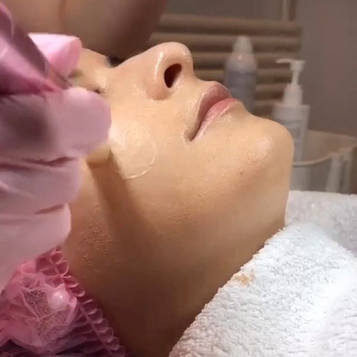 MicroNeedling BB Glow à Caluire-et-Cuire (69) Par Cécile - Estheca