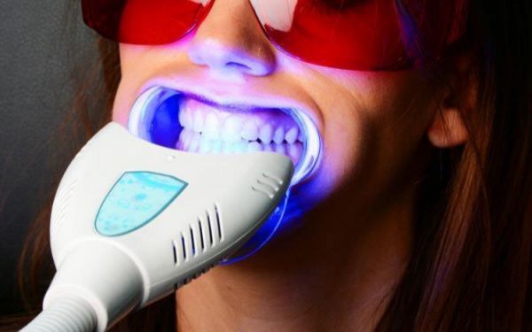 À Metz | Blanchiment dentaire | Les meilleures esthéticiennes