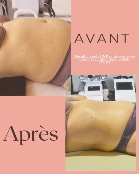 À Belfort | Drainage lymphatique Renata França | Les meilleures esthéticiennes