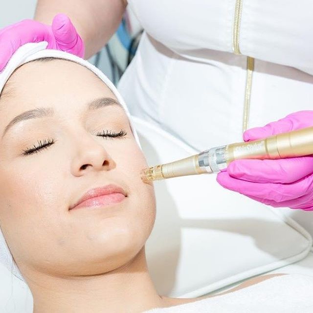 À Cherbourg-Octeville | MicroNeedling BB Glow | Les meilleures esthéticiennes