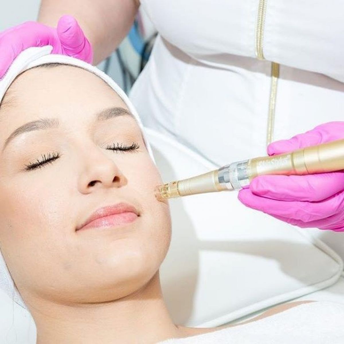 MicroNeedling BB Glow à Nègrepelisse (82) Par Caroline - Estheca