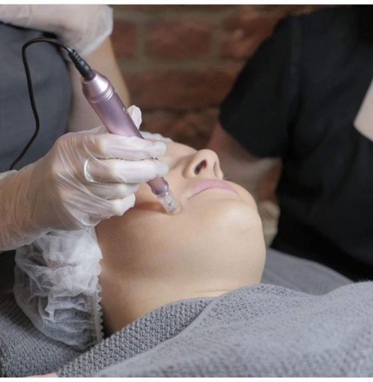 Formation Microneedling + BB Glow à Lille (59) Par Hajar - Estheca