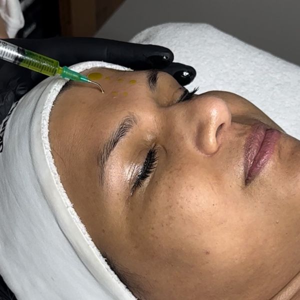 À Theix | Peeling BioRePeel | Les meilleures esthéticiennes
