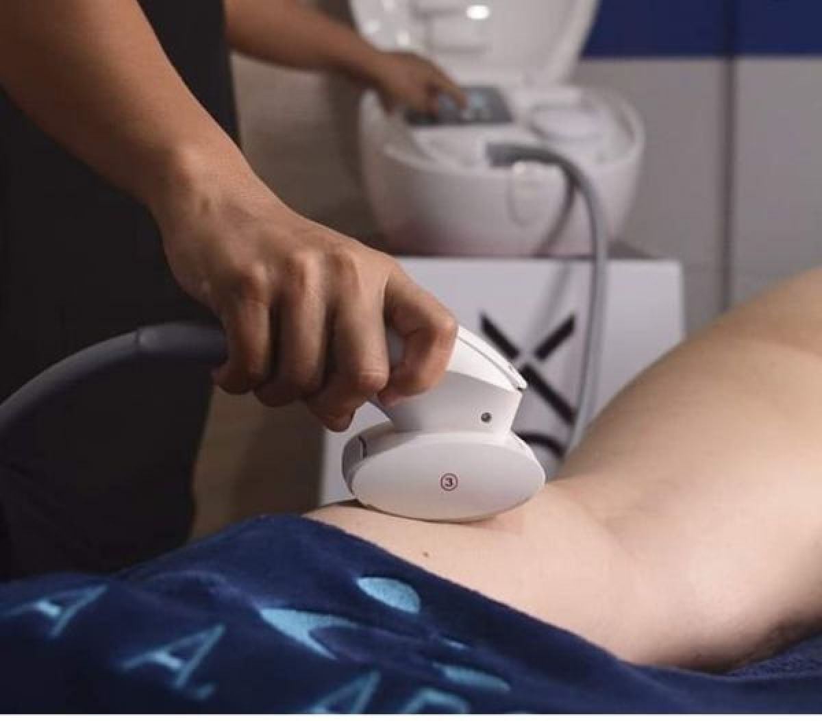 LPG: Traitement de la cellulite  à Saint-Brieuc (22) Par Nour - Estheca