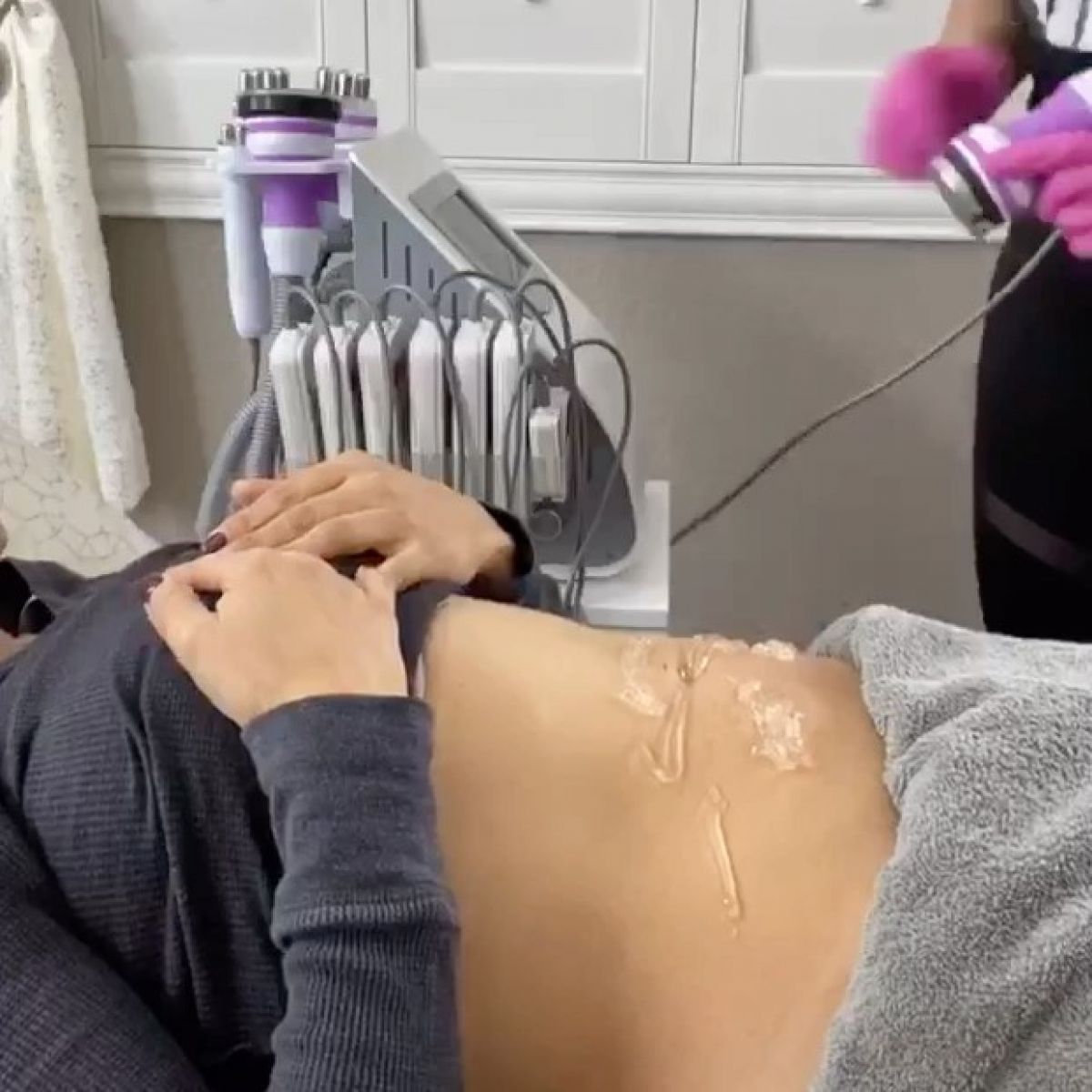 Radio fréquence et Lipocavitation à Saint-Sébastien-sur-Loire (44) Par Marion - Estheca