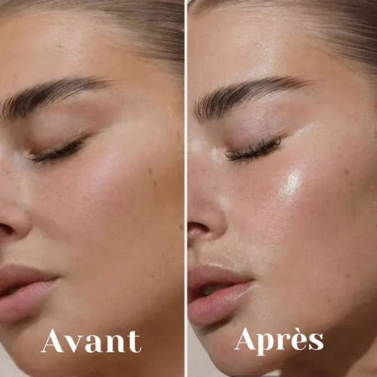 Glass Skin à Aix-en-Provence (13) Par Myriam - Estheca